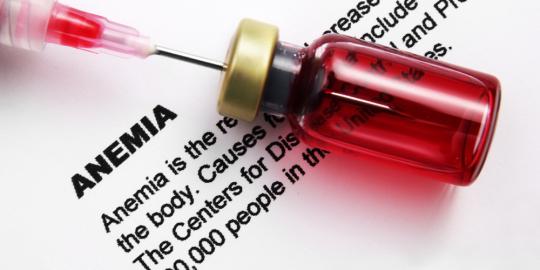 Top remedies in fighting anemia