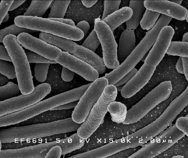 How to treat E-coli